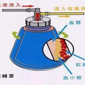 xʽѪҺɷַxO(sh)Ru(png)r(ji)ע(c)g(sh)ָ(do)ԭt